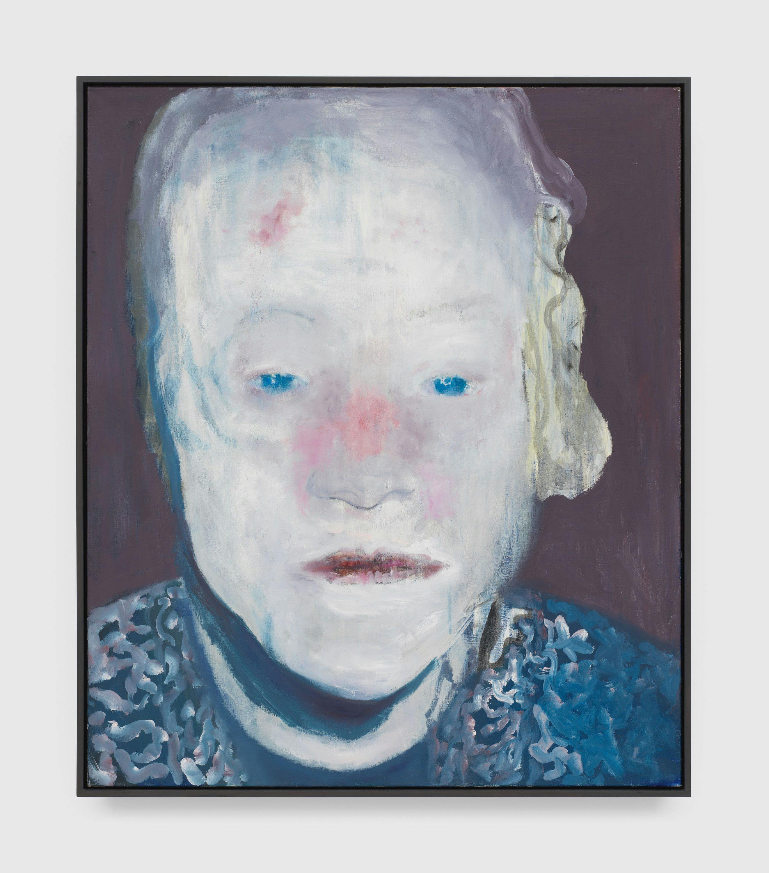 A painting by Marlene Dumas, titled The White Disease, dated 1985.